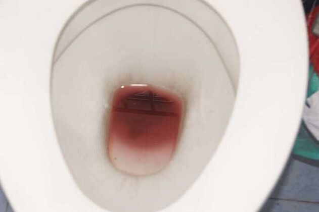 تظهر البقع عندما يكون الرجال متحمسين